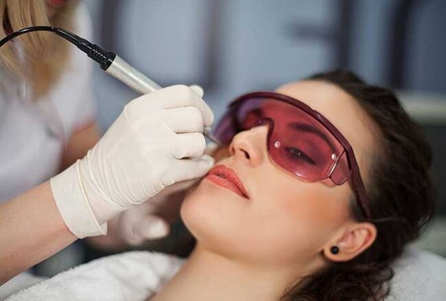 Laserbiorevitaliseerimine