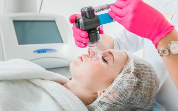 Naha laser noorendamine