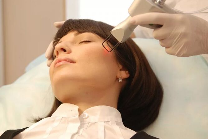 Laser noorendamine
