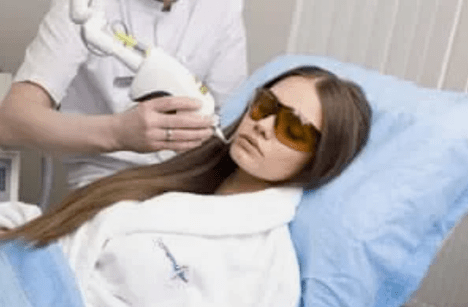 fraktsionaalne lasernoorendamine